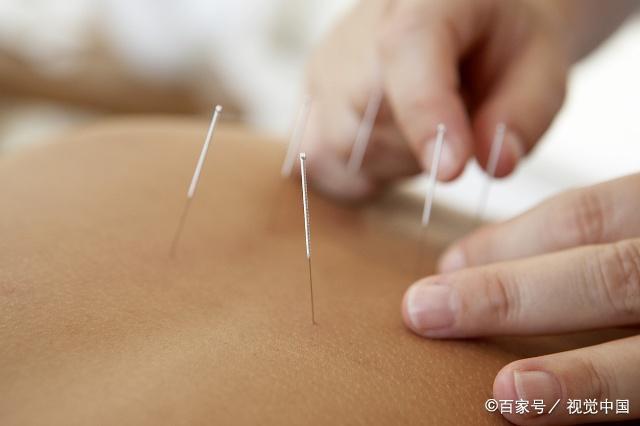 中医针灸_针灸可以治疗哪些病_针灸减肥_针灸的作用