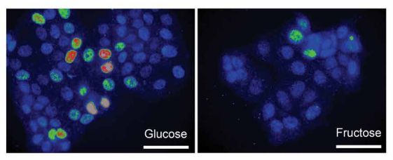 Science子刊！癌细胞依靠原始的能量产生途径来增殖和扩散