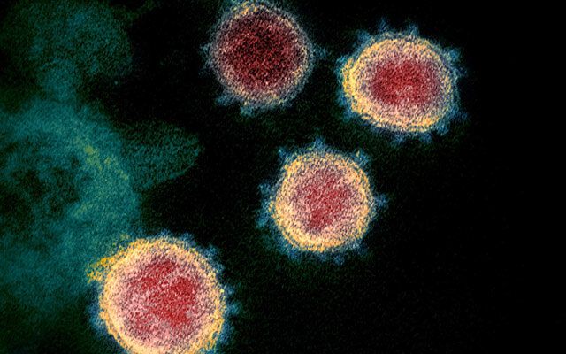 Viruses：滅活SARS-CoV-2的新方法,！助力新冠肺炎安全研究！