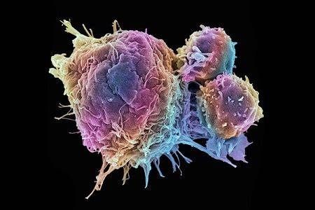 Nature #160;Cancer #160;阻断肿瘤信号可以阻止癌症的扩散