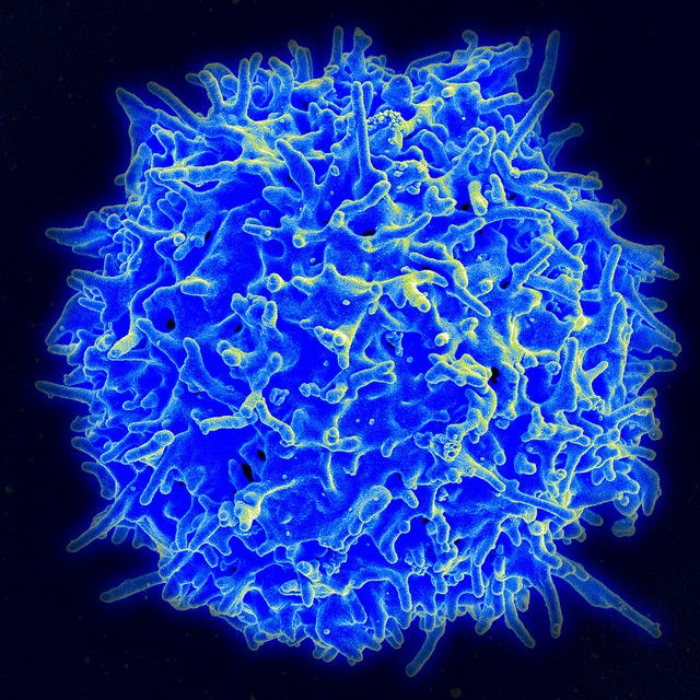 Front #160;Immuno：细胞因子风暴和T细胞计数可能为如何治疗COVID-19提供线索