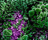 Nature：医院空气中检测出高浓度SARS-CoV-2的RNA!