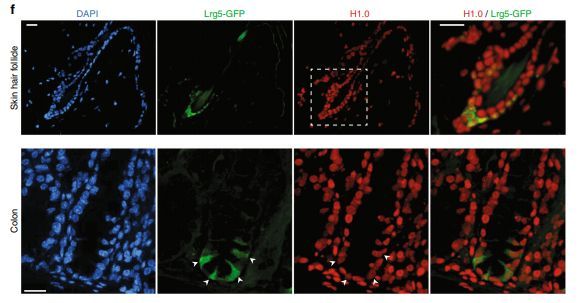 Nature子刊：新型药物成功阻止癌症转移！