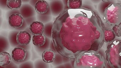 Clinical #160;Proteomics：研究助理卵巢癌的早期诊断