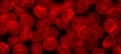 Inter #160;Immunopharma：新方法可預(yù)測免疫療法的效果與風(fēng)險(xiǎn)
